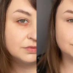 Porównanie przed i po: jak nakładać korektor pod oczy, by ukryć cienie i rozjaśnić spojrzenie. Efekt wow!