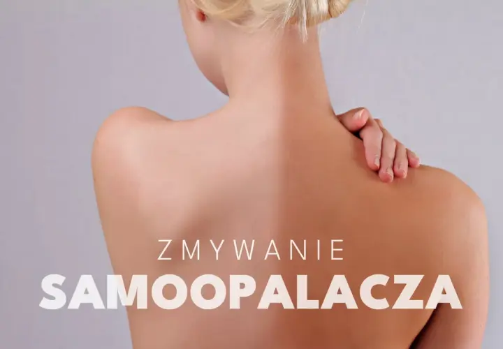 Widoczne nierównomierne **plamy po samoopalaczu** na plecach i ramionach kobiety. Tekst: "Zmywanie samoopalacza".