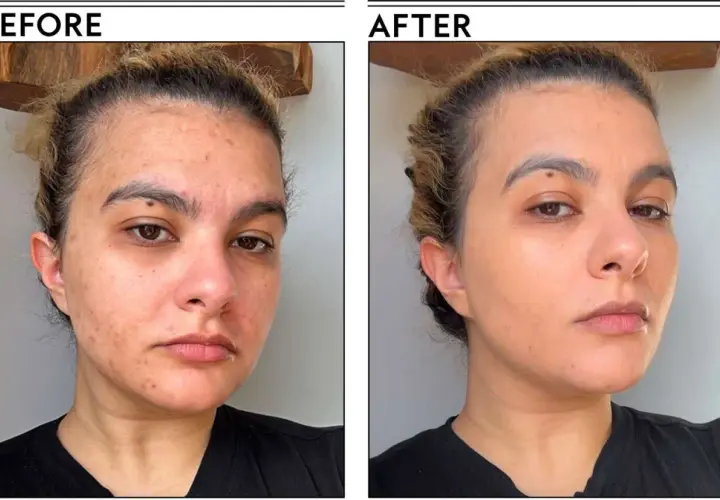 Przed i po: skóra z niedoskonałościami i zaczerwienieniami po zastosowaniu podkładu Tirtir Mask Fit Red Cushion, który wyrównał koloryt i ukrył zmiany.