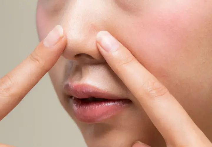 Dłonie dotykają nosa, ukazując drobne niedoskonałości i nadmiar sebum na twarzy.