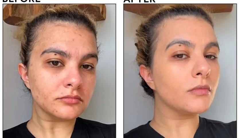 Przed i po: skóra z niedoskonałościami i zaczerwienieniami po zastosowaniu podkładu Tirtir Mask Fit Red Cushion, który wyrównał koloryt i ukrył zmiany.
