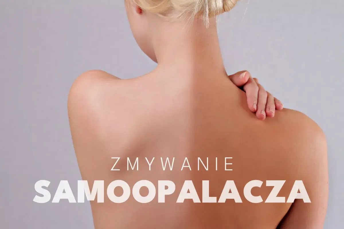Widoczne nierównomierne **plamy po samoopalaczu** na plecach i ramionach kobiety. Tekst: "Zmywanie samoopalacza".