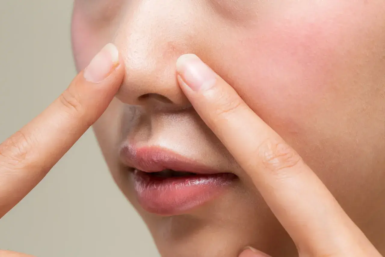 Dłonie dotykają nosa, ukazując drobne niedoskonałości i nadmiar sebum na twarzy.