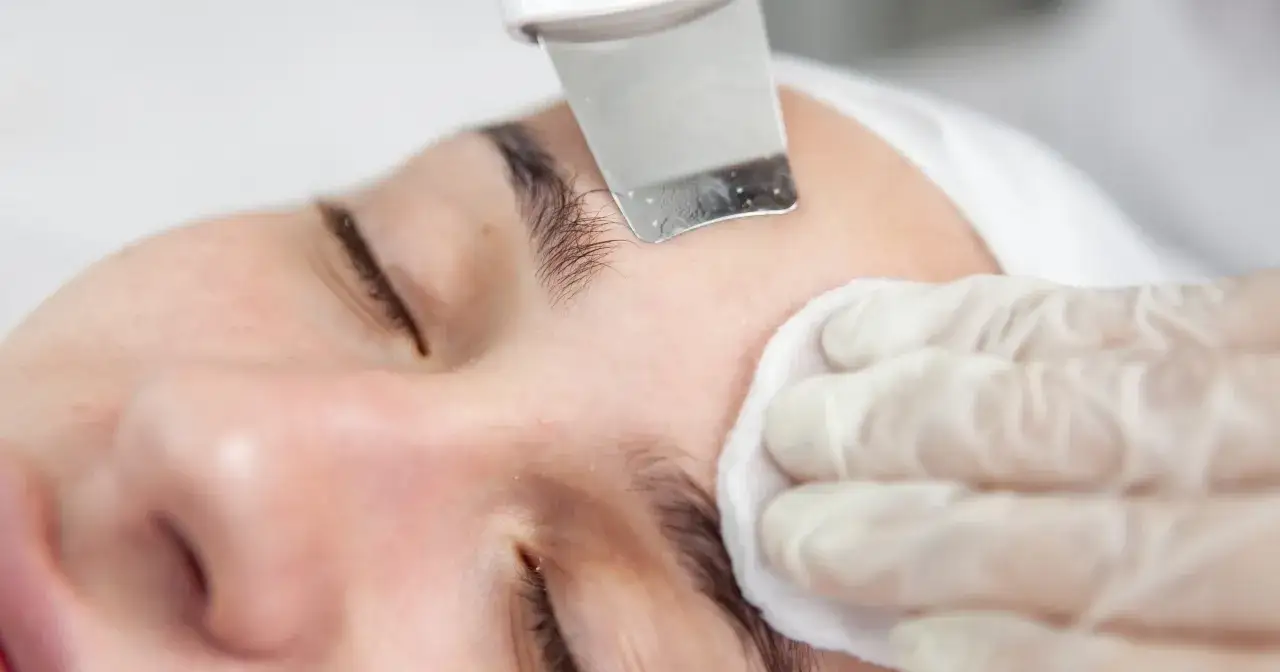 Zabieg oczyszczania sk&oacute;ry twarzy. Zanim zdecydujesz się na peeling kawitacyjny, sprawdź przeciwwskazania.
